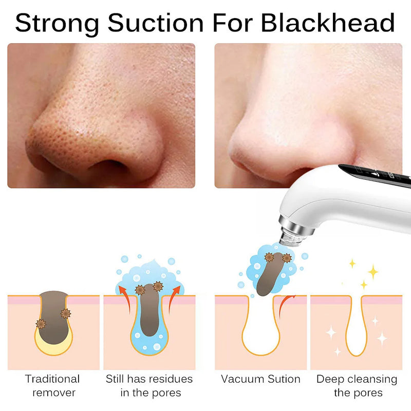 Pimple Black Head Removal Face Cleaner