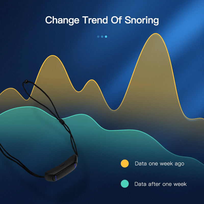 EMS Pulse Smart Anti Snoring Device